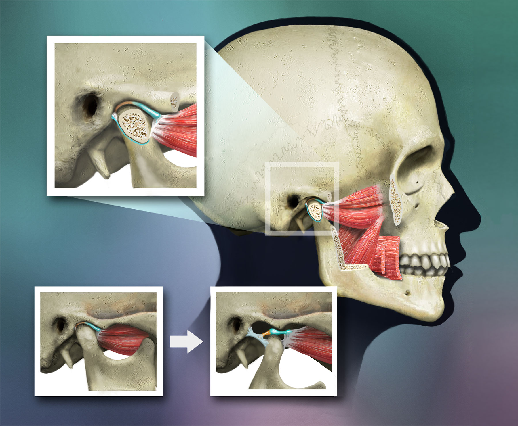 Muscles Skull